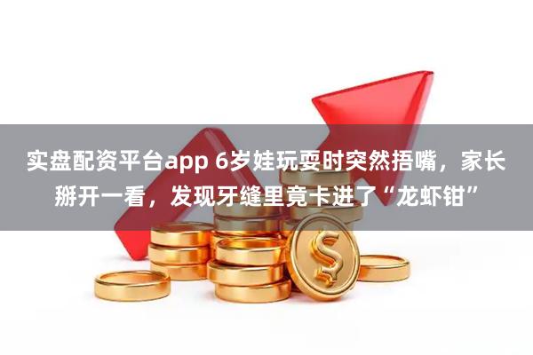 实盘配资平台app 6岁娃玩耍时突然捂嘴，家长掰开一看，发现牙缝里竟卡进了“龙虾钳”